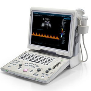 CX2000 Laptop Color Doppler Ultrasound System