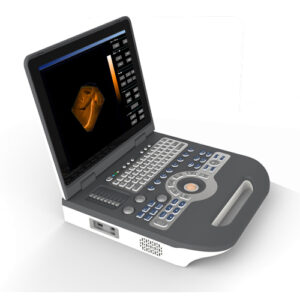 ST-6800 Notebook Digital Diagnostic Ultrasound System