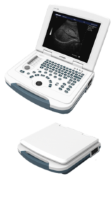 ST580 Notebook Digital Diagnostic Ultrasound System